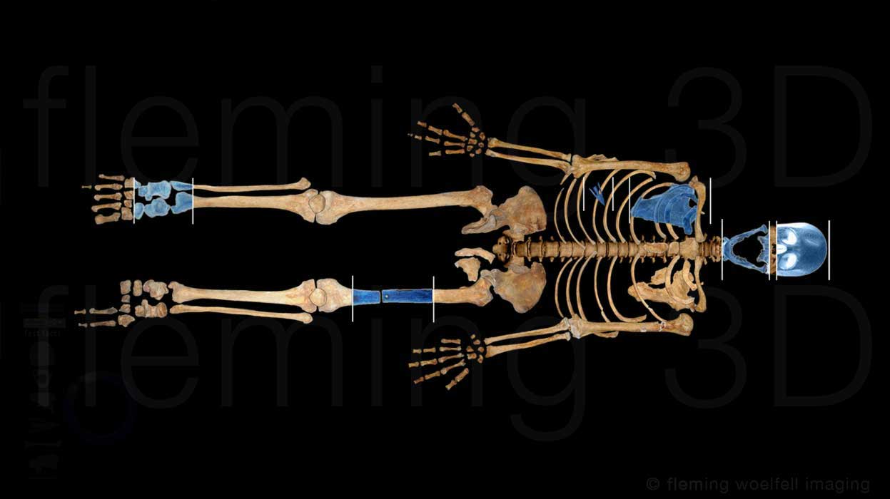 Stirling skeleton examinations