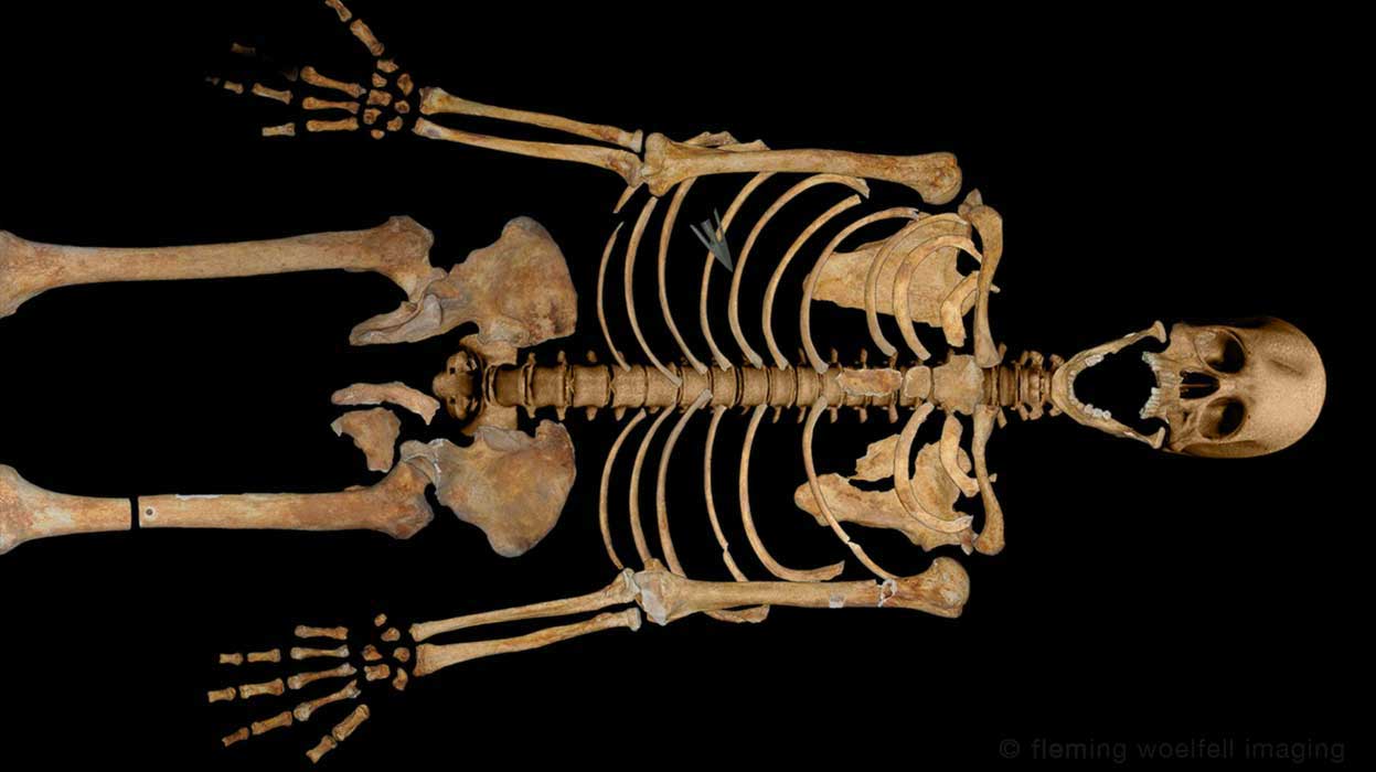 Stirling medieval skeleton