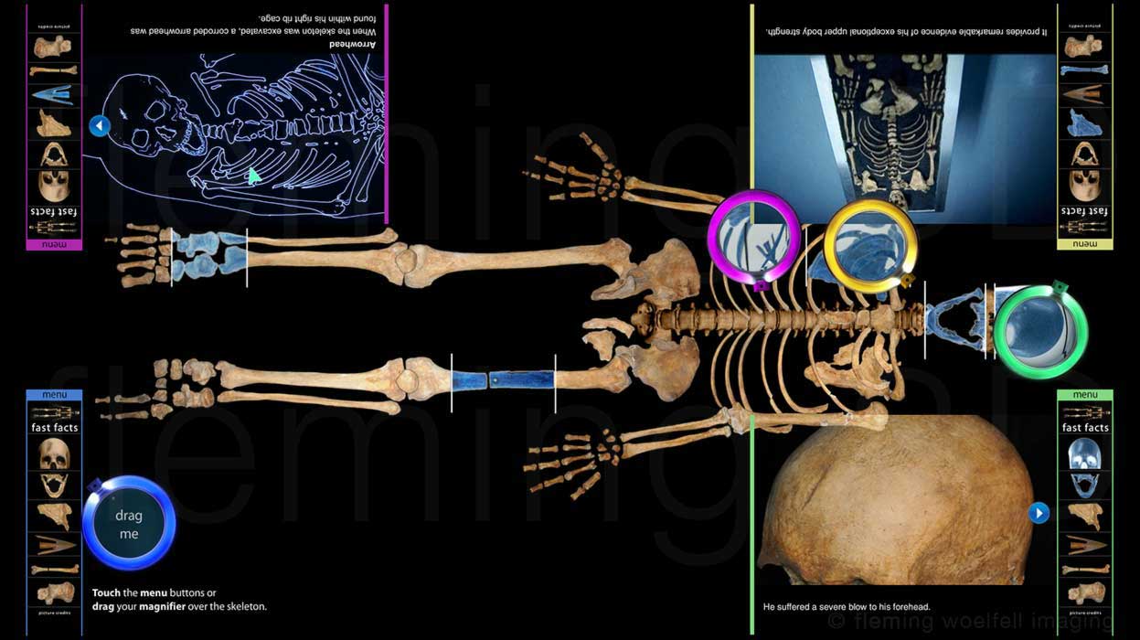 Stirling skeleton autopsy